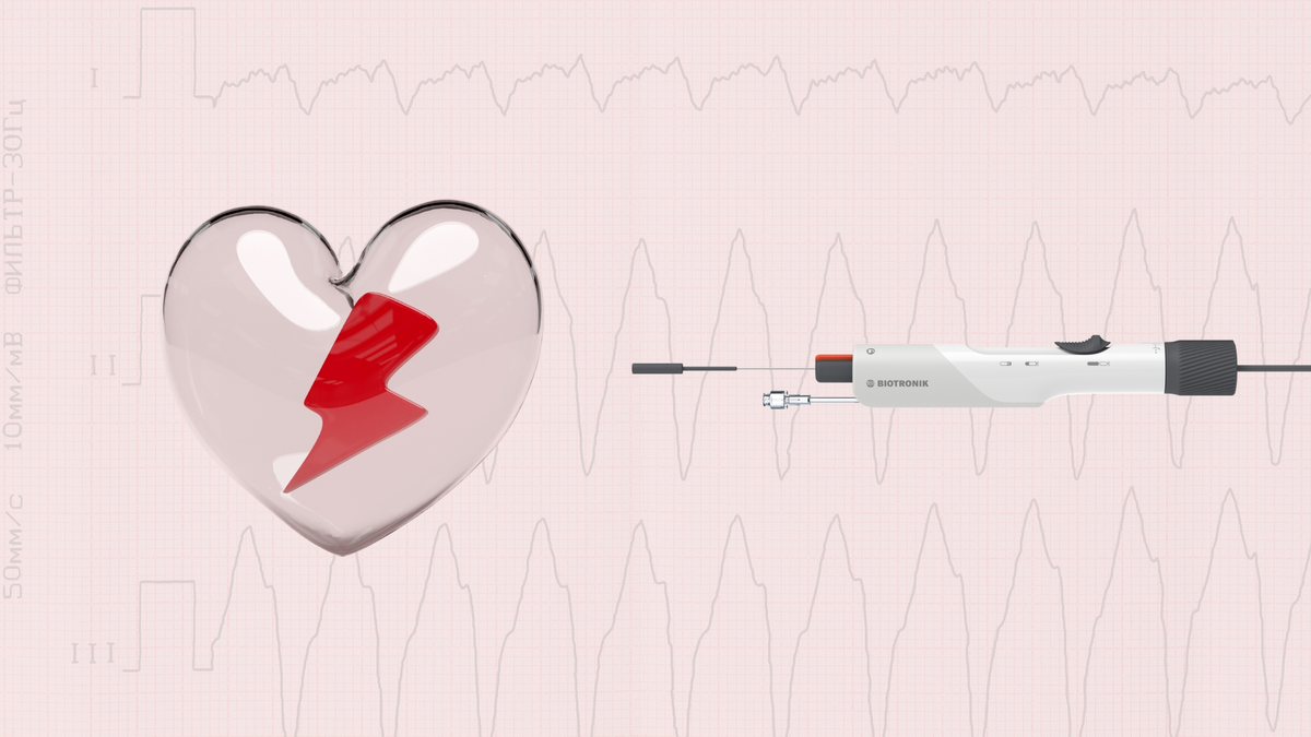 Biotronik's Leadless Pacemaker Detects Atrial Signals - International ...