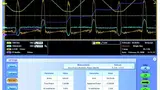 Ergebnisse von Power-Quality-Messungen mit der DPOPWR-Software.