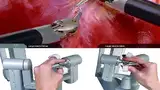 Bild 2: Die Chirurgen positionieren ihre Hände auf spezialisierten Steuerelementen. Das »da-Vinci«-System berechnet die Bewegung in Echtzeit und steuert die Roboterarme auf der Robotikplattform.
