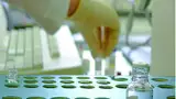 Bild 1: Laboranalysen müssen möglichst schnell erfolgen und immer mehr Parameter abdecken. Dies gelingt nur mit mehr Automatisierung, die allerdings oft die internen Stromnetze überlastet und zu Gerätefehlern führt.