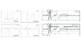 Bild 2: Links sind die Wellenform-Vorlagen dargestellt, die zur Klassifizierung der Spitzen in der R-Welle herangezogen werden. Das Diagramm rechts oben zeigt das Ergebnis der Klassifizierung mit dem Standard-Referenzalgorithmus (OSEA). Abgesehen von