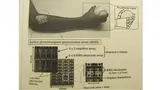 Das 64-Kanal-Oberflächen-EMG-Messfeld.