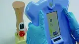 Bild 3: Wunden-Messsystem von Eykona im Betrieb