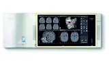 Bild 2: »Intelligente« Algorithmen ermöglichen Zusatzinformationen in Patienten-Bilddaten, beispielsweise die dreidimensionale Darstellung aus ursprünglich planaren Schichtdaten einer Computertomographie