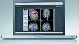 Bild 4: Zwei IP-Video-Kanäle in HD-Qualität ermöglichen die Übertragung bzw. Aufzeichnung von Videodaten als Live-Stream oder Digitales Recording aus dem OP