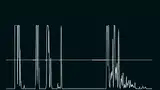 Bild 1: Mit der A-Scan-Sonde lassen sich Ultraschallwellen durch Linsentrübungen hindurch übertragen, zum Beispiel um die axiale Länge des Auges zu messen (hier dargestellt) oder für diagnostische Scans
