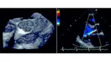 Bild 1: Selbst dreidimensionale Bilder oder Aufnahmen von Bewegungsabläufen lassen sich mit Hilfe von Sonographen erzeugen - allerdings ist diese Technik sehr anfällig für Störungen 