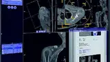 Bild 3: Die »Syngo.via General Engine« umfasst neue Anwendungen, die in hohem Maße automatisiert und standardisiert sind. Dazu gehört die Applikation »Anatomical Range Presets«, mit deren Hilfe sich schnell und präzise die optimale Ansicht der zu dia