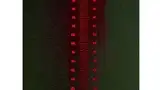 Bild 4: In einer Radiotherapie-Anwendung projiziert ein Laser eine Messskala auf den Patienten, um den Abstand zwischen Strahlenquelle und Patient exakt bestimmen und die Strahlendosis entsprechend einstellen zu können 
