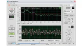 Screenshot des ST-100 Signal Viewer [3]: Im oberen Fenster ist die Frequenzanalyse des Ausgangssignals dargestellt