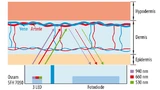 Bild 1: Grundprinzip der reflektiven, optischen Pulsmessung