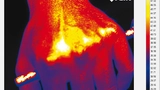 Bild 1c: Diese Wärmebild, das nach der Einwirkung der Infrarotlampe aufgenommen wurde, zeitn die thermoregulatorische Antwort des menschlichen Körpers auf thermische Reize