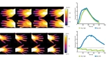 Bild 2: Die thermografischen Aufnahmen und der Graph eines gesunden Probanden der Pilotstudie (oben) zeigen eine normale thermoregulatorische Antwort auf den thermischen Reiz. Die untere Bildfolge und der Graph zeigen, dass das thermoregulatorische S