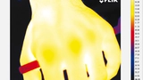 Bild 1a: Dieses Wärmebild, das vor  der Einwirkung der Infrarotlampe aufgenommen wurde, zeigt die thermoregulatorische Antwort des menschlichen Körpers auf thermische Reize 