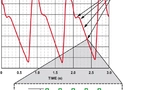 Bild 4: Abgetastetes PPG-Signal mit fünf LED-Impulsen pro Datenpunkt 