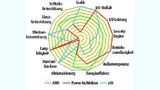 Stärken und Schwächen der verschiedenen Prozessor-Architekturen.