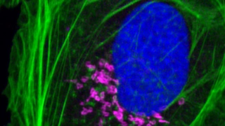 Mit dem Verfahren sFLIM können drei verschiedene Zellstrukturen gleichzeitig mit demselben Fluoreszenzfarbstoff markiert und unterschieden werden.
