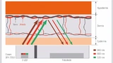 Bild 1: Ein PPG-Sensor sendet grünes, rotes oder infrarotes Licht aus, welches Haus, Gewebe und Blutgefäße durchstrahlt und auf den Detektor reflektiert wird. Weil Blut Licht absorbiert, lässt sich aus dem Detektorsignal die Herzfrequenz ableiten.