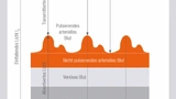 Bild 2: Detektorsignal einer PPG-Messung. Nur die in den Arterien pulsierende Blutmenge trägt zum veränderlichen Signalanteil bei. Das Verhältnis Imin/Imax ist maßgeblich für die Berechnung der Sauerstoffsättigung des Bluts (Pulsoxymetrie). 