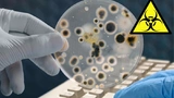 Bild 3: Keimoase: Tastaturen sind Ausgangspunkte von Kreuzkontaminationen. 