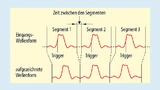 Aufzeichnungsmethode mit segmentierbarem Speicher