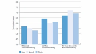 Bei Aufnahmetechnik ohne Streustrahlenraster zeigen sich die Verbesserungen am deutlichsten bei normalgewichtigen und adipösen Patienten. Dies ist der sehr kritische Bereich, weil in diesen Fällen der negative Einfluss der Streustrahlung am stärksten
