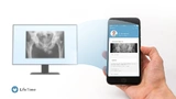 Bild 2. Die LifeTime-App soll Diagnosen, Befunde und Therapievorschläge einfach, kostengünstig und sicher zugänglich machen. 