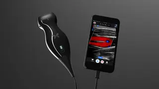 Rasierer trifft Handy, aber nur auf den ersten Blick. Denn beim Butterfly iQ handelt es sich um ein tragbares Ultraschallgerät, dass die Untersuchung mit dem Smartphone möglich macht.