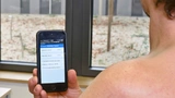 Der Glukosesensor wird am Oberarm unter die Haut implantiert, die Werte werden an das Smartphone geschickt und über eine App ausgelesen.