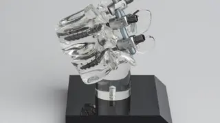 latz 9: Roboter bei Wirbelsäulenoperationen Mit einer neuen Methode sollen Stabilisierungsschrauben in der Wirbelsäule sicher, genau und ohne Verletzungen des umliegenden Gewebes angebracht werden können. Grundlage dafür bilden verschiedene patentier