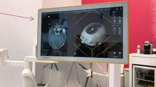 Das Programm von Brainlab berechnet die exakte Stelle …