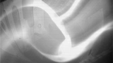 Plasma
