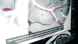 Brainlab-Software