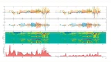 Aus den Rohdaten mehrerer Sensoren lässt sich über verschiedene Filter eine Kennlinie extrahieren, die Anomalien erkennbar macht
