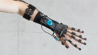 Das Sensorarmband schickt Muskelsignale an den Computer im Rucksack. Er erkennt, dass der Patient eine Bewegung beabsichtigt und unterstützt ihn mit entsprechenden Kräften