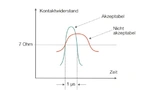Bild 1: Akzeptanzkriterien für die Kontaktunterbrechung