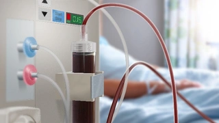 Die Cortec-Füllstandsensoren eignen sich unter anderem für Dialyse-Geräte.