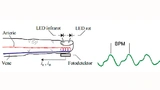 Das Signal des Fotodetektors (Photoplethysmographie) enthält die Pulsfrequen