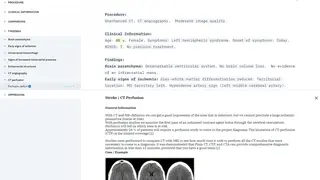 Infobox mit Hintergrundinformationen und Bildbeispielen der CT-Perfusions-Technik.