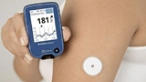 Das FreeStyle Libre 2-Messsystem wird bequem am Oberarm getragen.