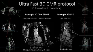 Ultraschnelles 3D CMR Protokoll