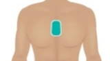 Patient mit Smart Patch auf der Brust
