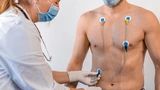 Mithilfe der Cardisiographie lässt sich eine Minderdurchblutung des Herzens nicht-invasiv und innerhalb kürzester Zeit erkennen.