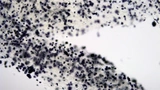 Mikroskopische Aufnahme von biogedrucktem Hydrogel mit darin enthaltenen Zellansammlungen. Diese wurden mit MTT-Färbung sichtbar gemacht. Die im Labor angezüchteten Zellen formen nach einigen Tagen inselähnliche Zellverbünde und produzieren Insulin.