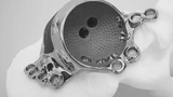 Hüftprothese aus dem 3D-Drucker: Mit modernster Lasertechnik lassen sich passgenaue Prothesen erzeugen.
