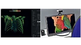 Medizinische Bildgebung als live 3D-Holo-Kommunikation