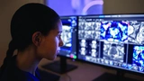 Themenwoche Radiologie Medizintechnik Künstliche Intelligenz Röntgen Ultraschall MRT CT