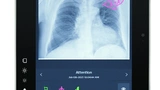 Themenwoche Radiologie Medizintechnik Künstliche Intelligenz Röntgen Ultraschall MRT CT