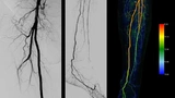 Medizintechnik Krebs Radiologie Siemens Healthineers