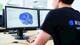 Medizintechnik Additive Fertigung 3D-DRuck Implantate Kranial